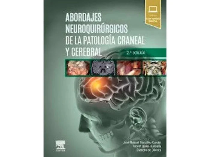 Abordajes Neuroquirúrgicos de la Patología Craneal y Cerebral + Acceso Online