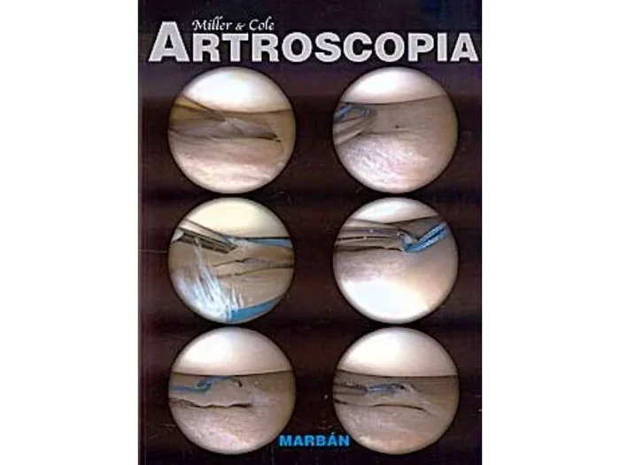 Artroscopia (Tapa Blanda)