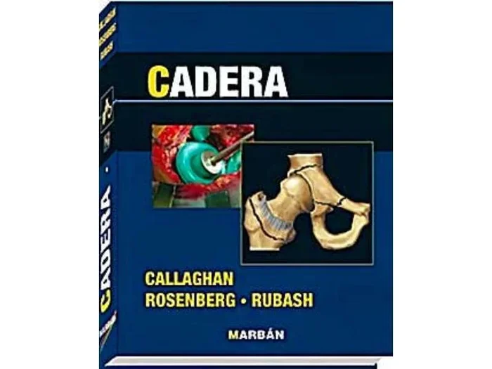 Cadera