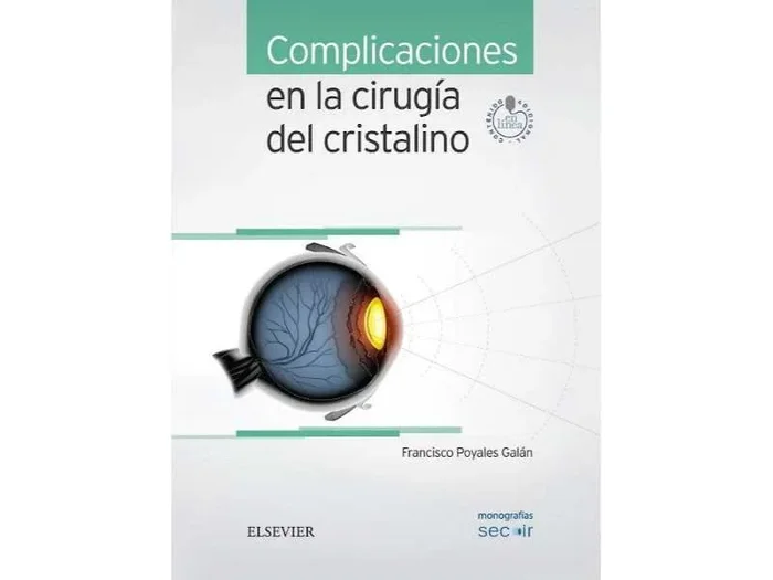 Complicaciones en la Cirugía del Cristalino (Monografías SECOIR)