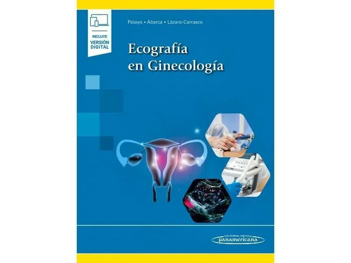 Ecografía en Ginecología