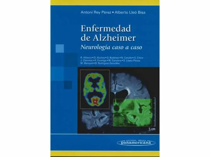 Enfermedad de Alzheimer. Neurologia caso a Caso