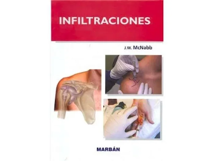 Infiltraciones