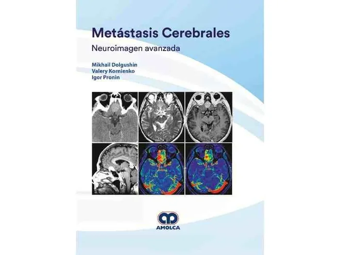 Metástasis Cerebrales. Neuroimagen Avanzada