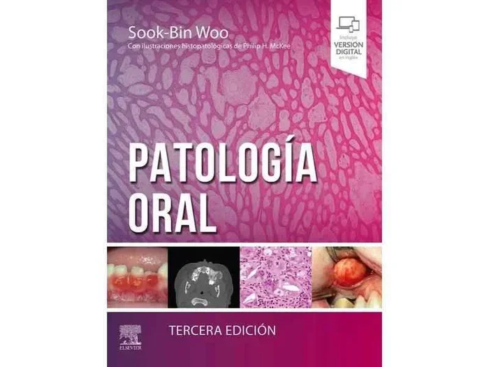 Patología Oral