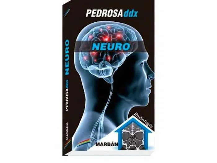 Pedrosa ddx: Neuro