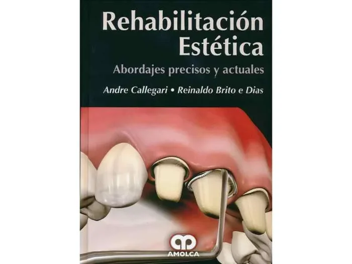 Rehabilitación Estética. Abordajes Precisos y Actuales