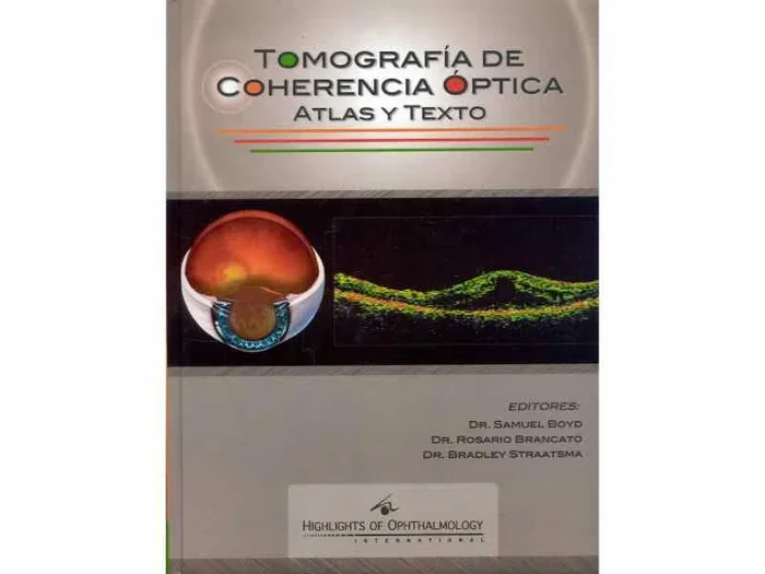 Tomografia de Coherencia Optica. Atlas y Texto